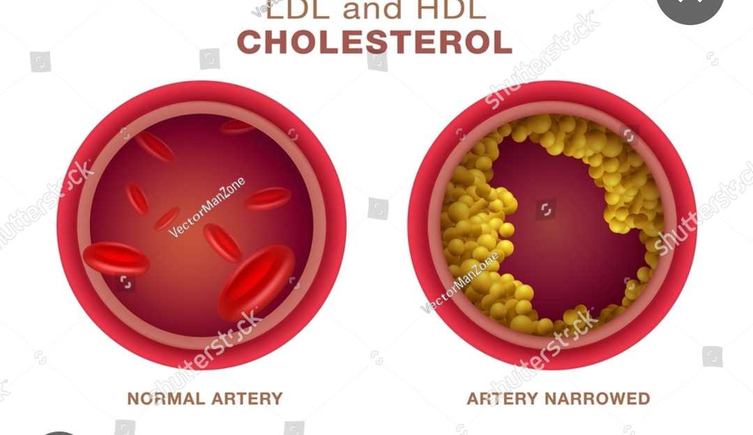 Normal Cholesterol levels