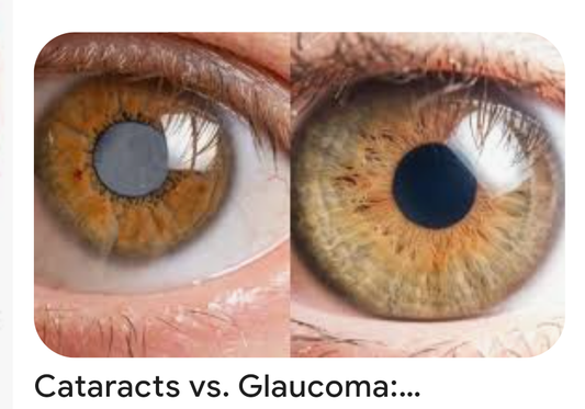 Glaucoma/Cataract Eye Support